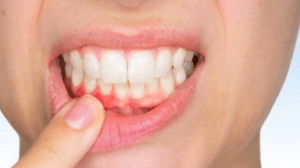 Çürüksüz Dişler İçin 10 Altın Kural