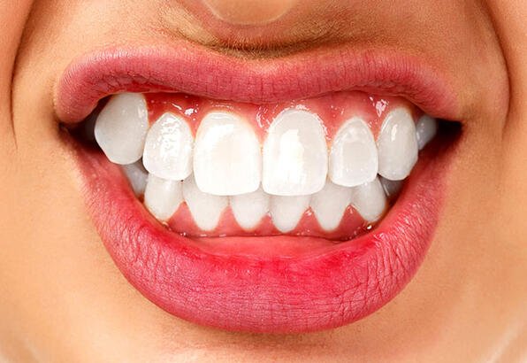 Boyun Ağrınızın Sebebi Dişleriniz Olabilir