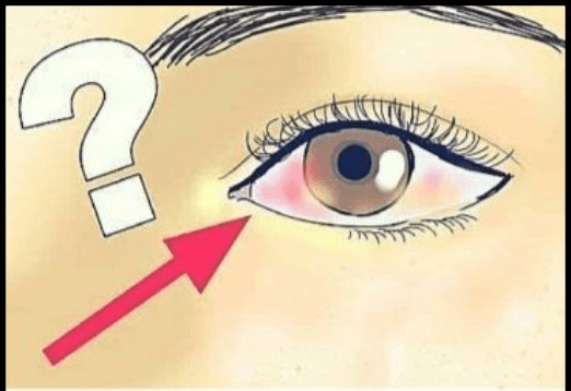 Gözlerinizin Sağlığınız Hakkında Söylemeye Çalıştığı 8 Şey